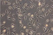 A cell’s-eye view of altered gravity and ageing