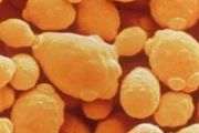 Yeast demonstrates survival skills under Mars conditions