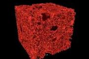 Flash frozen silicon reveals patterns mirroring early universe dynamics